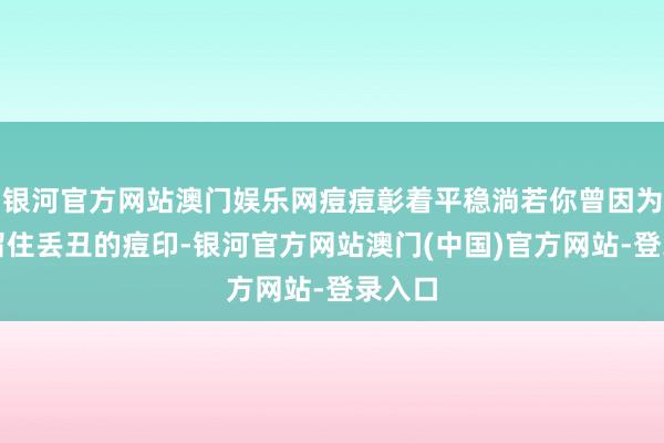 银河官方网站澳门娱乐网痘痘彰着平稳淌若你曾因为痘痘留住丢丑的痘印-银河官方网站澳门(中国)官方网站-登录入口