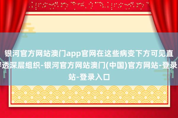 银河官方网站澳门app官网在这些病变下方可见直快穿透深层组织-银河官方网站澳门(中国)官方网站-登录入口